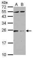 14-3-3 zeta antibody