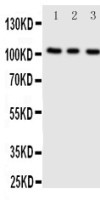 ADAMTS1 antibody