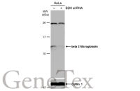 beta 2 Microglobulin antibody [N1C3]