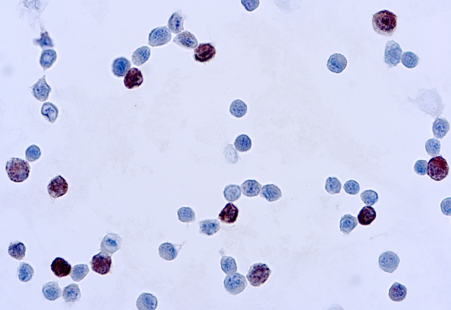 Adenovirus antibody [M58 + M73]