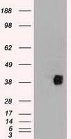 CD2 antibody [9D1]