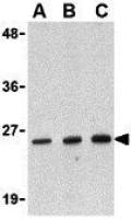 DEDD2 antibody