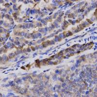 gamma Synuclein antibody