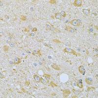 CaMKI gamma antibody