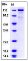 Human EPO receptor + IL3 Receptor beta Heterodimer protein, human IgG1 Fc tag