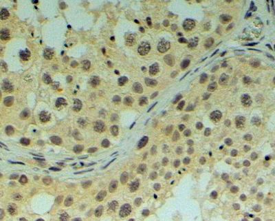 REV1 antibody, C-term