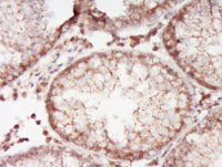 ABCA12 antibody