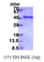 Human IMPAD1 protein, His tag (active)