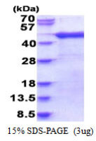Human ARFIP1 protein, His tag