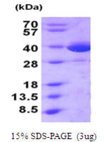 Human MIF protein, His tag