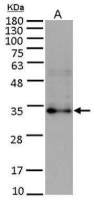 FGF10 antibody