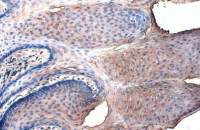 Collagen I antibody [COL-1]