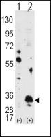 PIM1 antibody
