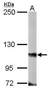 FOG2 antibody