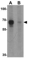 BCL6 antibody