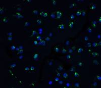 DAP Kinase 3 antibody