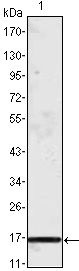 MCP1 / CCL2 antibody [1A7B8]