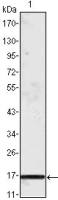 MCP1 / CCL2 antibody [1A7B8]