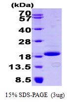 Human 4E-BP1 protein, His tag