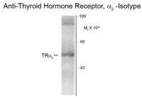Thyroid Hormone Receptor alpha antibody [1330]