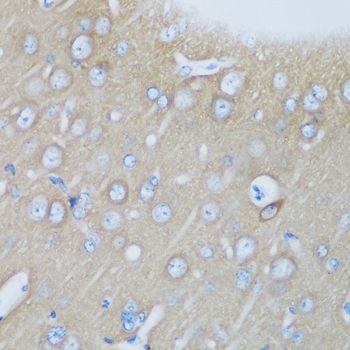 Visinin-like 1 antibody