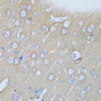 Visinin-like 1 antibody