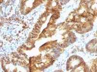 EAPII antibody [TDP2/1258]