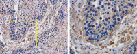PD1 antibody