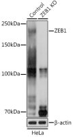 ZEB1 antibody