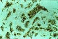 MVP/LRP antibody [1032]