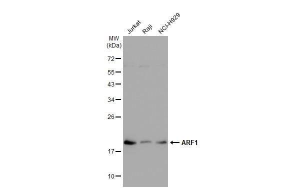 ARF1 antibody [GT1269]