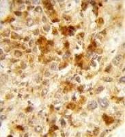 Peroxin 2 antibody, Internal