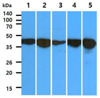 Aldolase C antibody [AT2E11]
