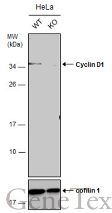 Cyclin D1 antibody [N1C3-2]