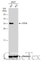 ETFA antibody