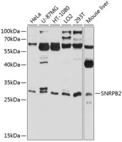 SNRPB2 antibody