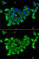 Carbonic Anhydrase 1 antibody