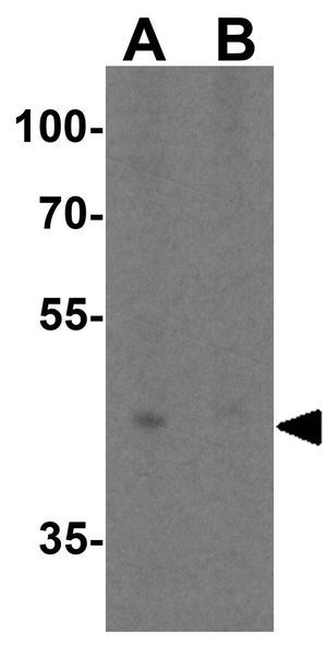 TIM-4 antibody