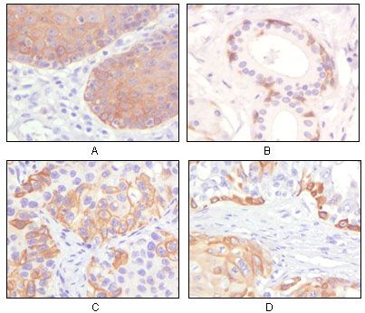 Cytokeratin 5 antibody [3E2F1]