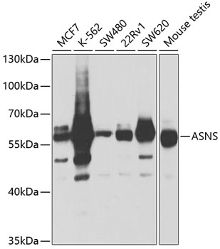 Asparagine synthetase antibody