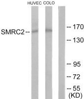 SMARCC2 / BAF170 antibody
