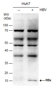 Hepatitis B virus X protein antibody [X36C]