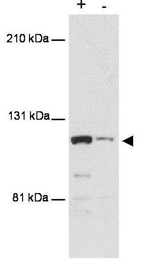 MTBP antibody [PHL-1]
