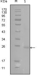 GATA3 antibody [1A10D1]