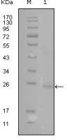GATA3 antibody [1A10D1]
