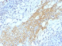 CD59 antibody [MACIF/1193]