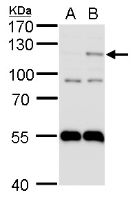 HIF2 alpha antibody [N1N3]