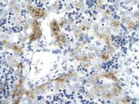 Topoisomerase II alpha antibody, C-term