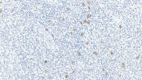 NCAM antibody [CD564]