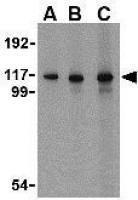 MDA5 antibody